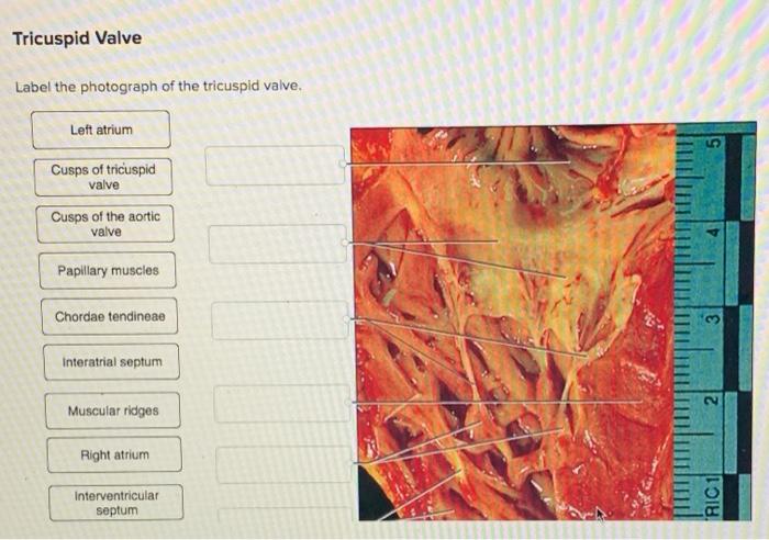 Label the photograph of the tricuspid valve