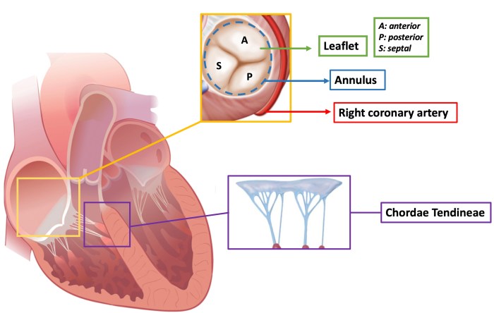 Label the photograph of the tricuspid valve