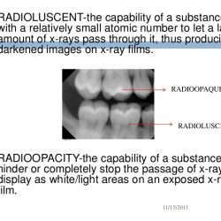 Which of the following is true of a radiopaque substance