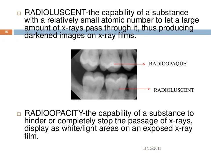 Which of the following is true of a radiopaque substance